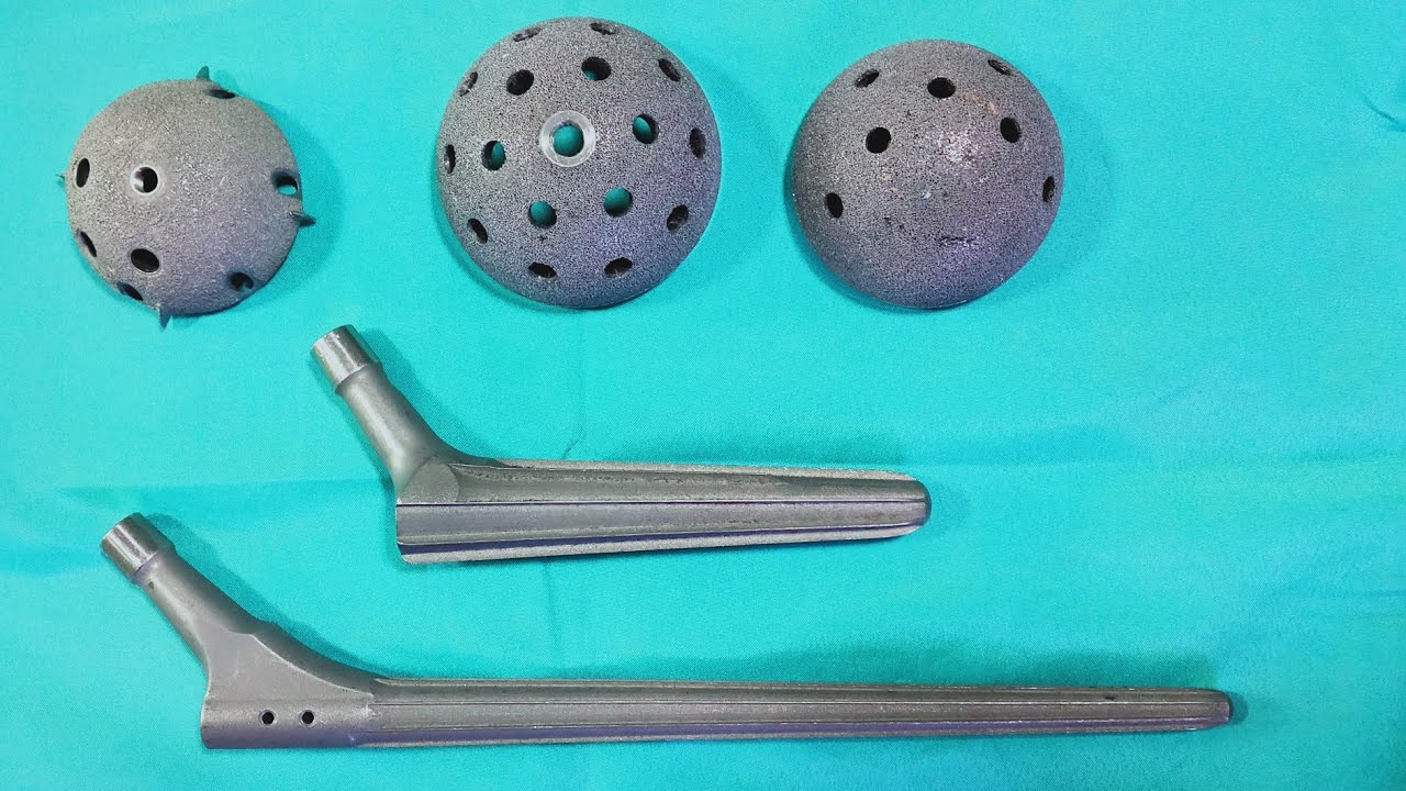 Implants for Revision Hip Replacement