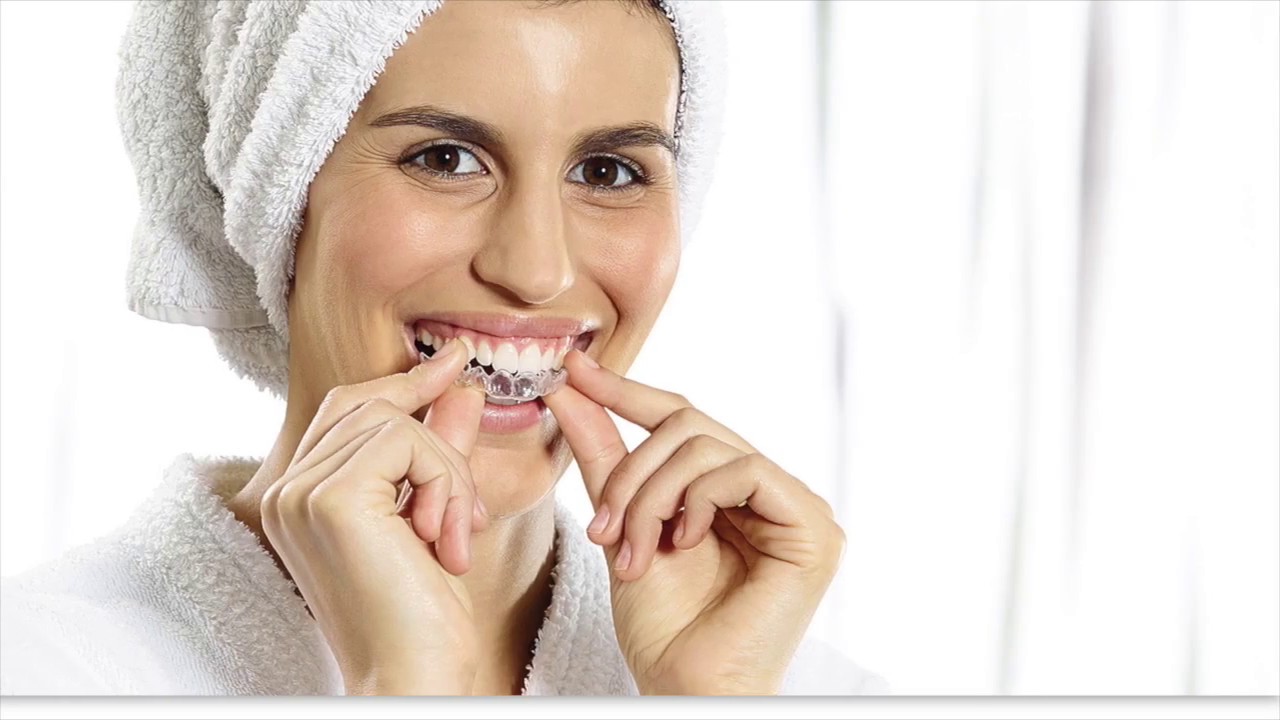 Accusmile - Sistema de alineadores Forestadent
