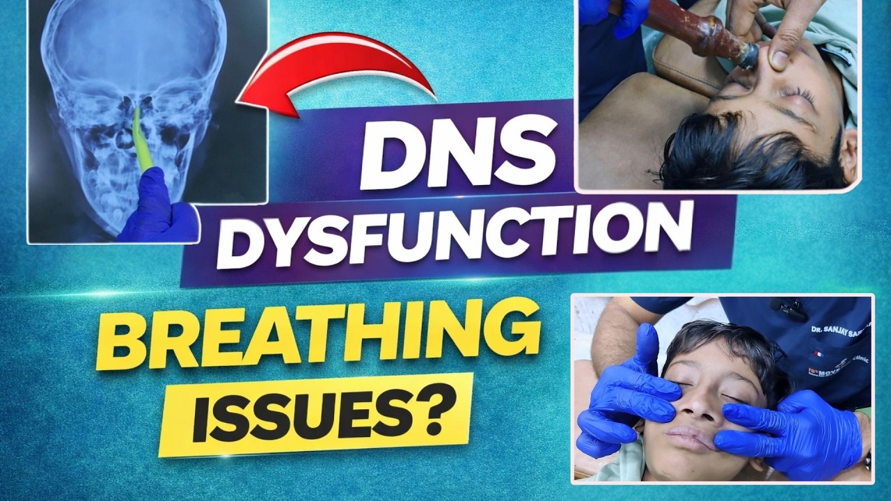 Искривление носовой перегородки? Лечение DNS у хиропрактика.