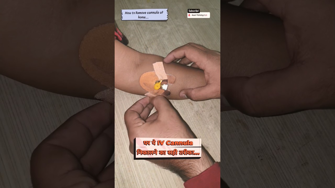 💉 IV Cannula Kaise Remove Kare | Hand Se IV Cannula Nikale Step by Step
