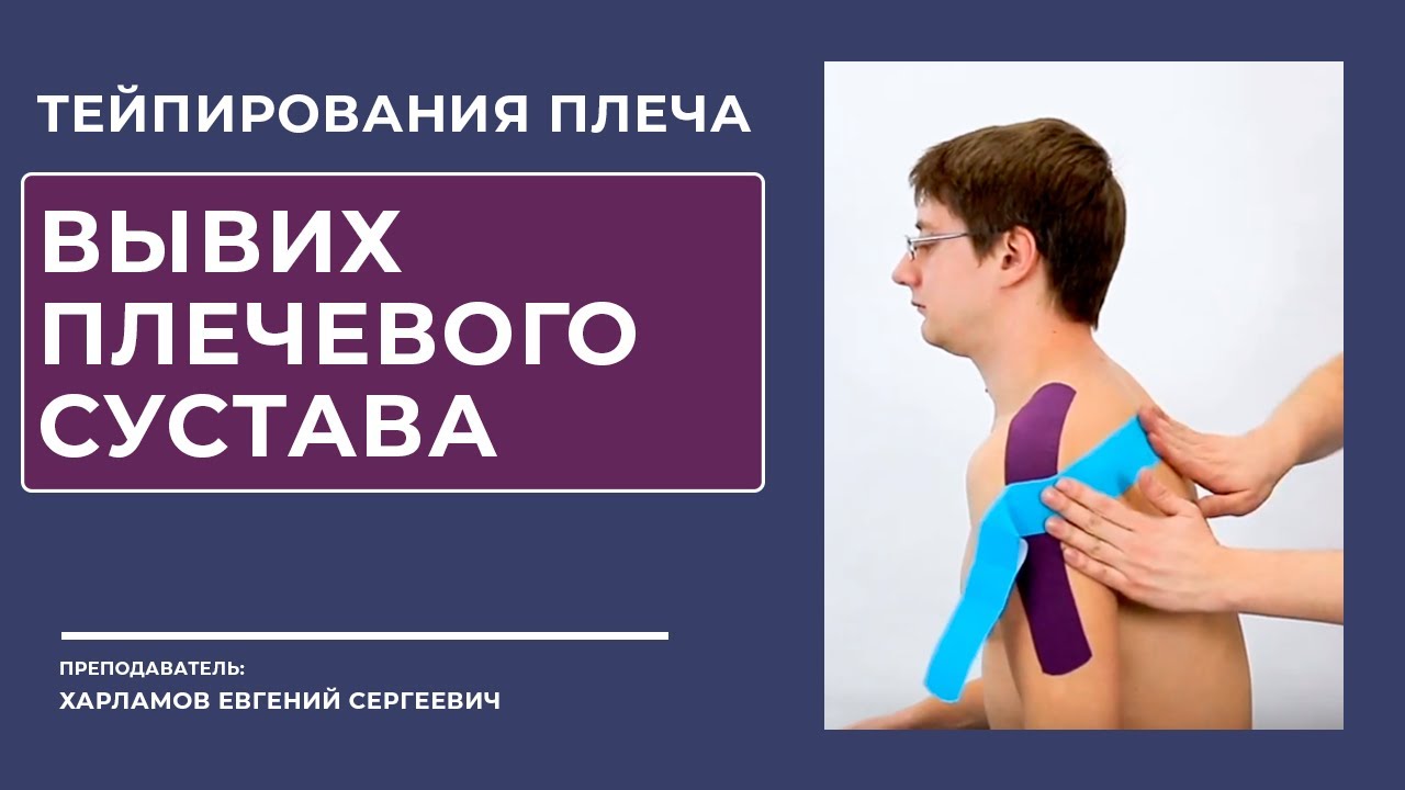 Тейпирование плеча.  Вывих в плечевом суставе