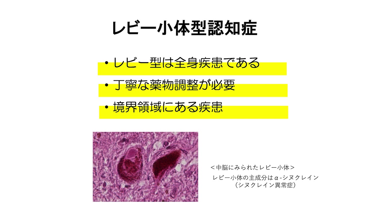 認知症の理解と対応　～認知症の種類と症状～