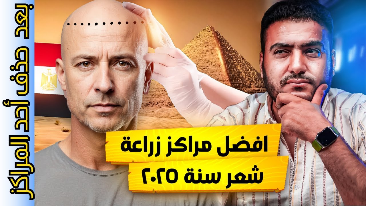 بعد حذف أحد المراكز - 4 أماكن مميزة لزراعة الشعر في مصر 2025 التي حققت نتائج مذهلة