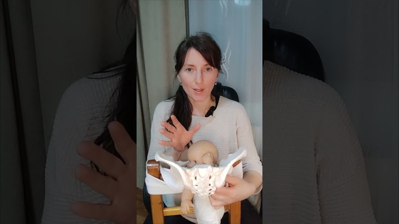 Механизм физиологических тазовых родов