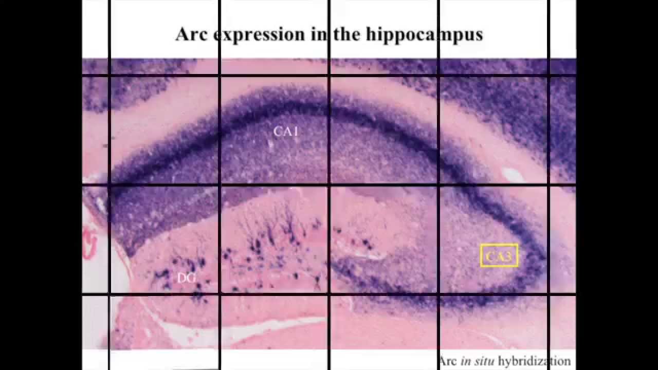 Hippocampal Memory Traces Are Differentially Modulated by Experience, Time, and Adult Neurogenesis