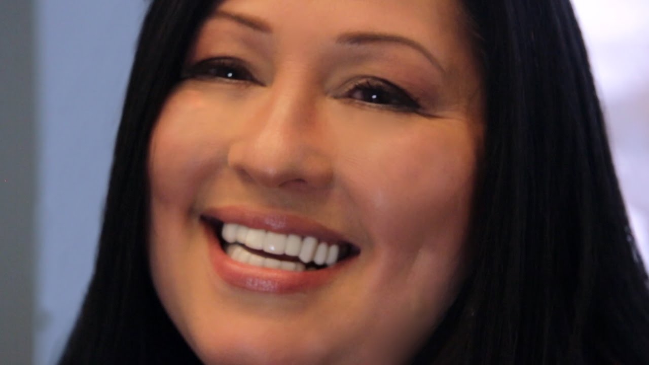 20 Ultra Thin Dental Veneers for $1,500! No Prep! and No Cosmetic Dentist! by Brighter Image Lab
