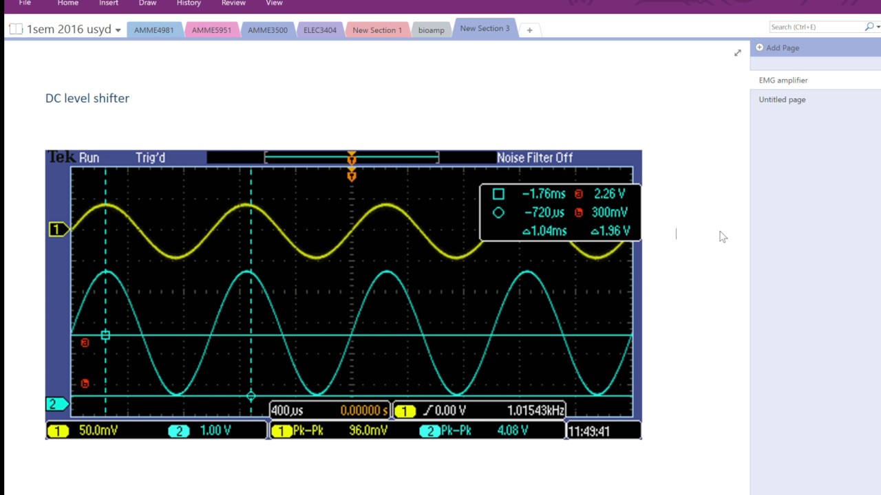 EMG amplifier 6: DC level shifter
