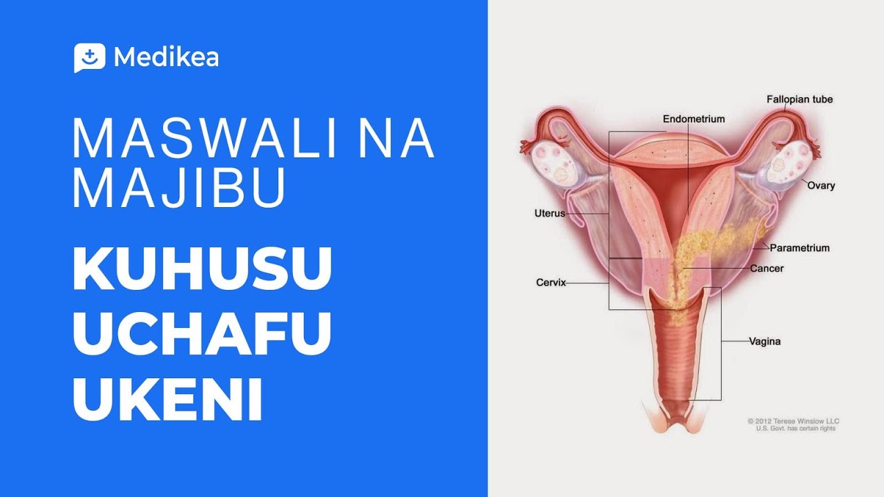 Majibu ya Maswali Yanayoulizwa Mara kwa Mara (FAQ)