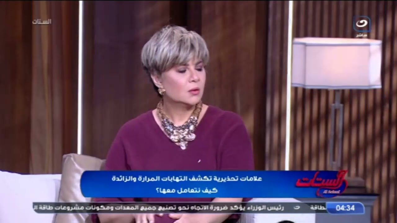 التكريع 