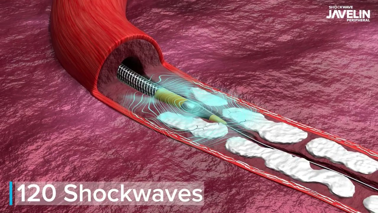 Shockwave Javelin Product Video (International)
