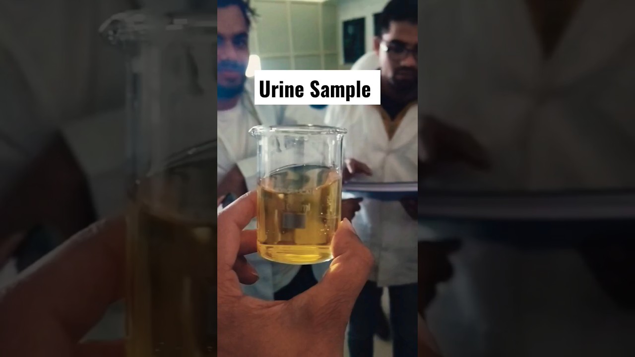 Urine Test...😊😊#shorts #ytshorts #laboratory