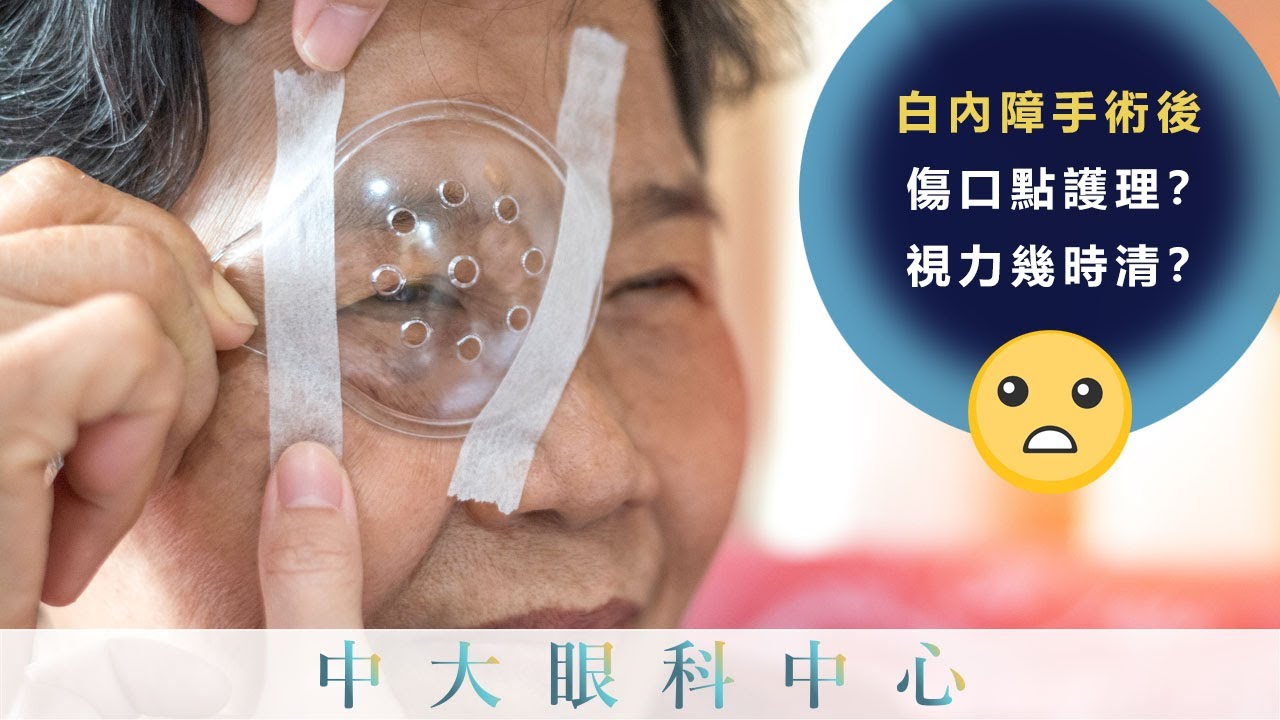 中大眼科 x 港台：做完白內障手術，傷口點護理？視力幾時清？