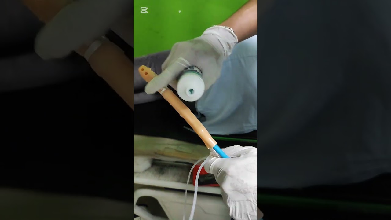 ENEMA DE BARIO