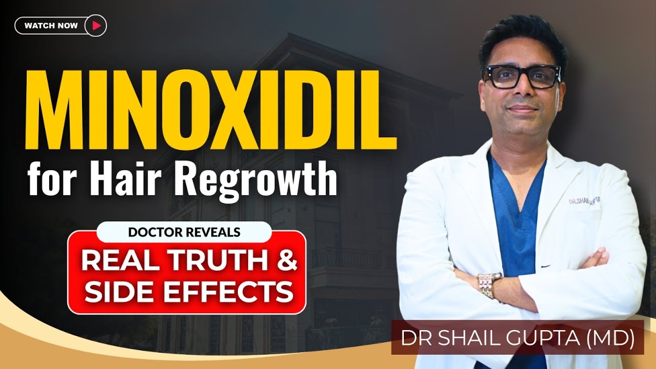 Kya Minoxidil Se Baal Wapas Aate Hain?  Minoxidil ke Fayde, Nuksan Doctor Explains |Dr Shail Gupta