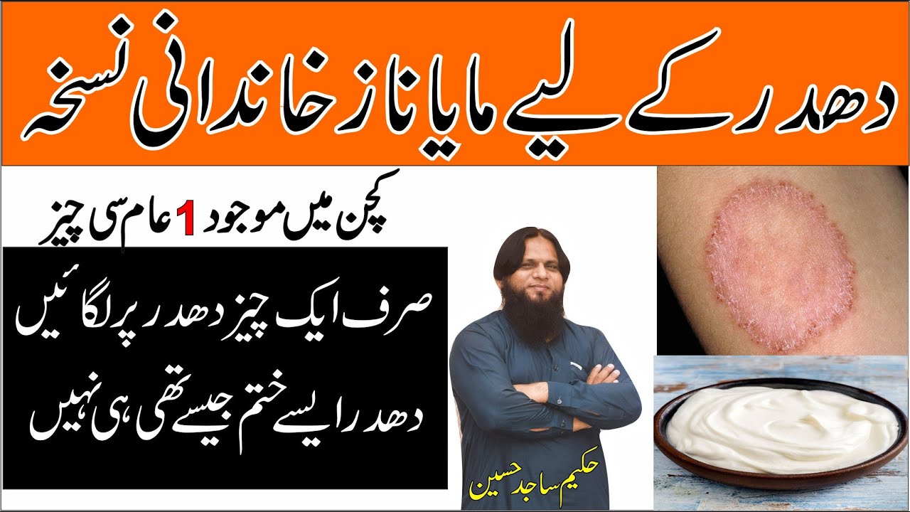 Dhadar,Chambal aur kharish ka ilaj | treatment of Psoriasis and ringworm in Urdu |BY HAKEEM SAJID