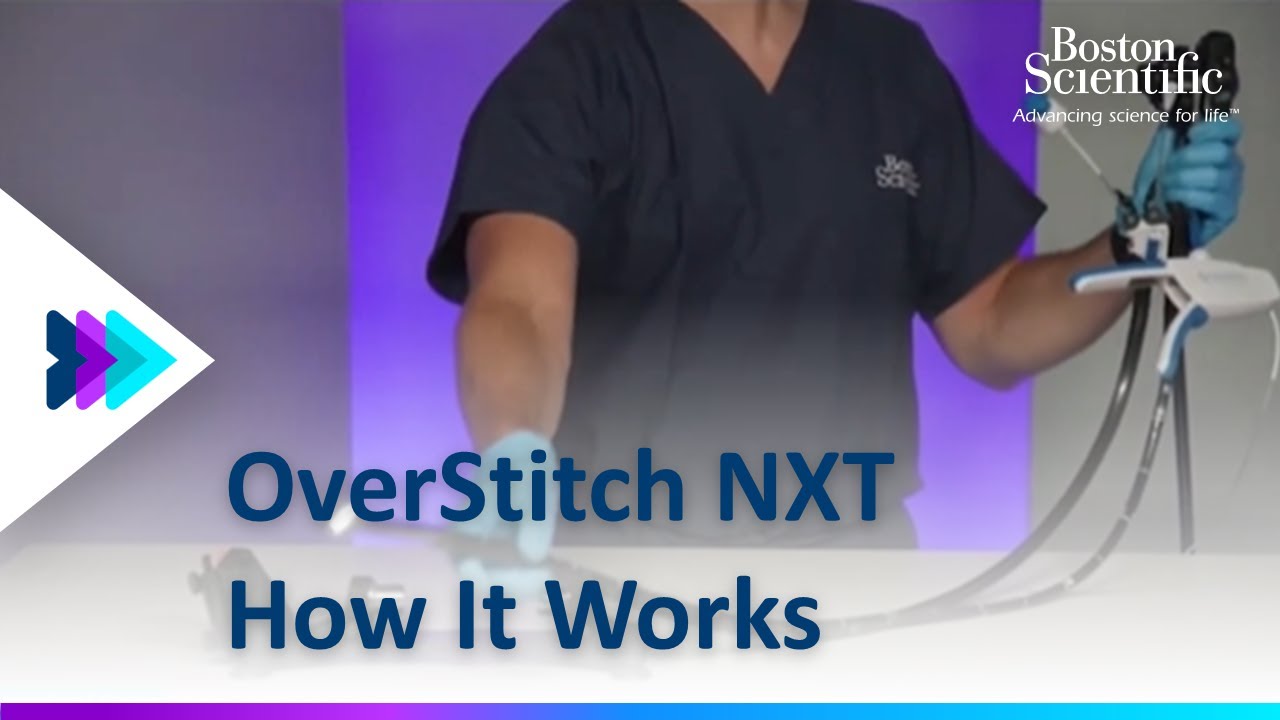 OverStitch™ NXT Endoscopic Suturing System: Step-by-Step Demonstration | Boston Scientific