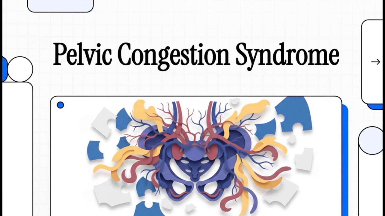 MET - 79 - Pelvic Congestion Syndrome - Explainer Video