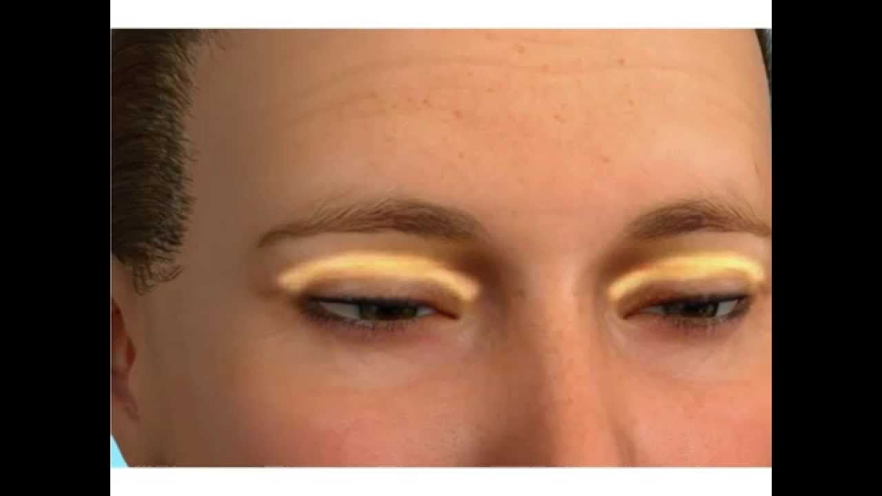 Oculoplastia COC