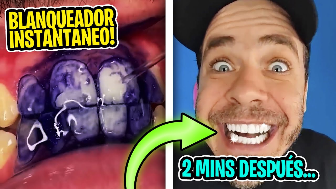 Blanquea tus dientes en segundos, 3 productos virales de internet // Pongamoslo a prueba