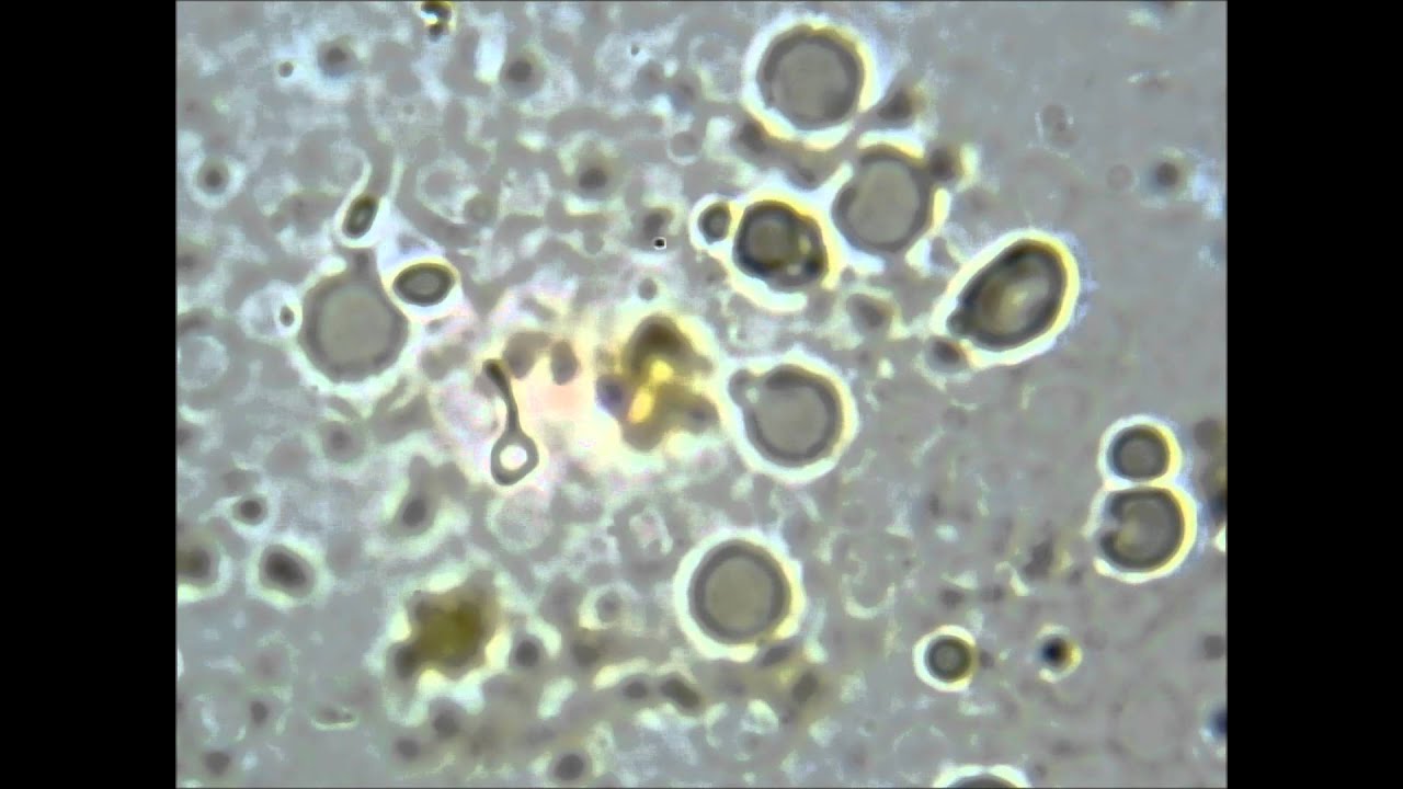 Spirochete turns into L-form in real time
