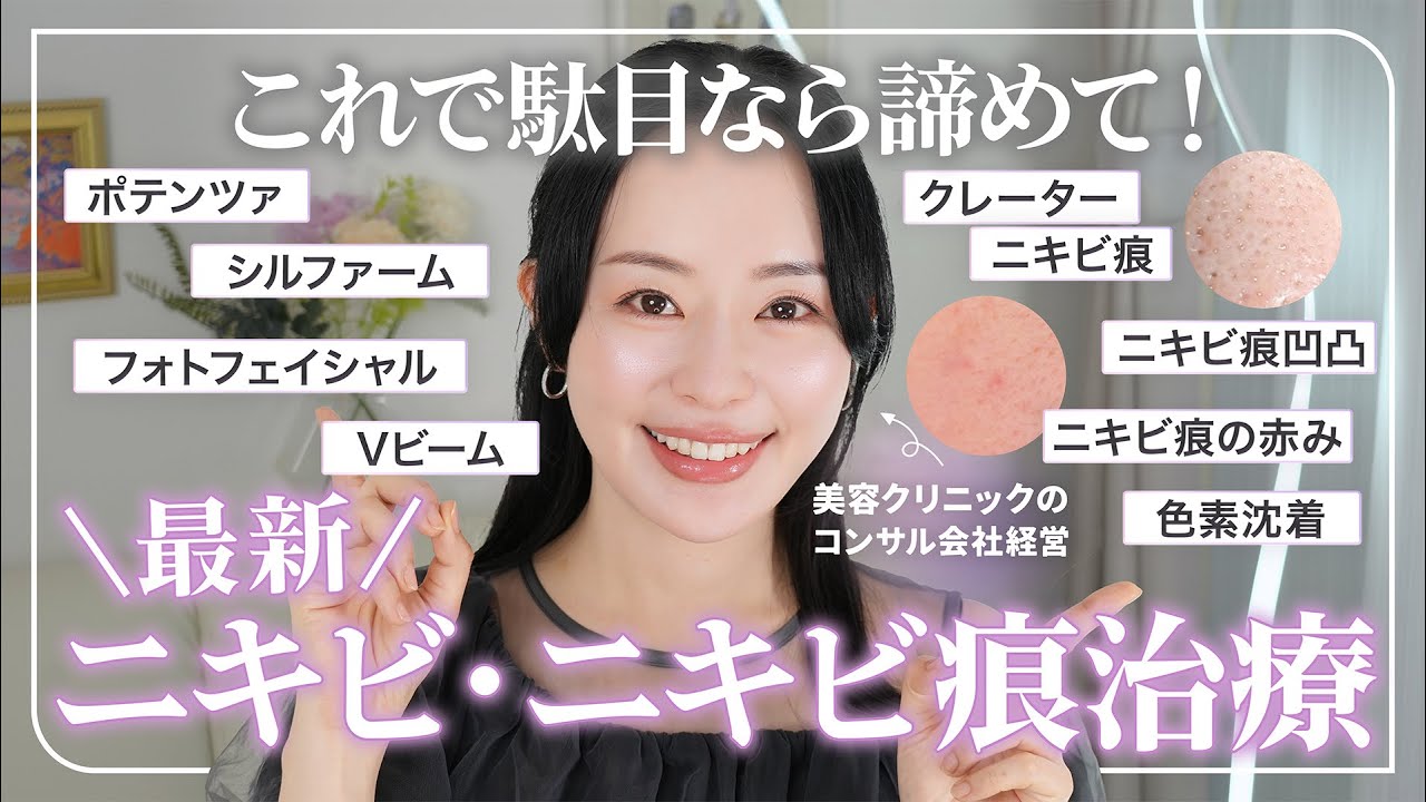 【最新ニキビ＆ニキビ痕治療】美容医療のプロが教える！お悩み別、今ニキビ跡を治すならこの治療です【クレーター・ニキビ痕の赤み】