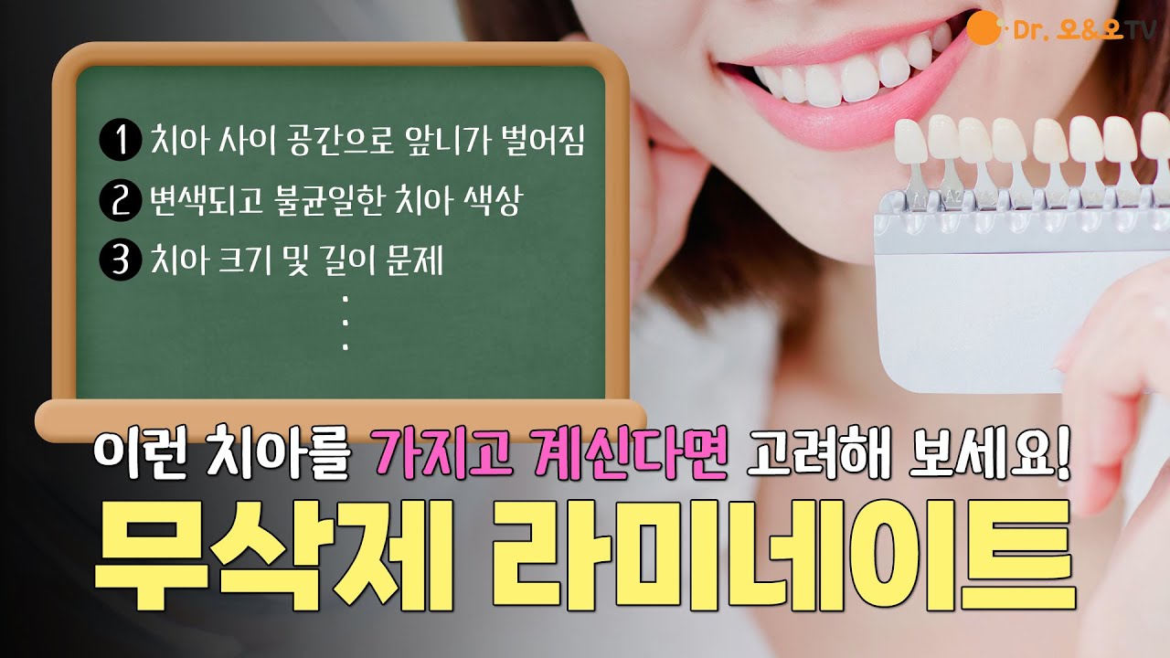 무삭제라미네이트, 이런 치아라면 가능합니다