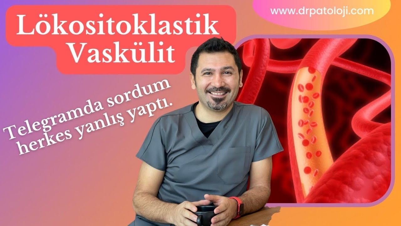 Lökositoklastik Vaskülit