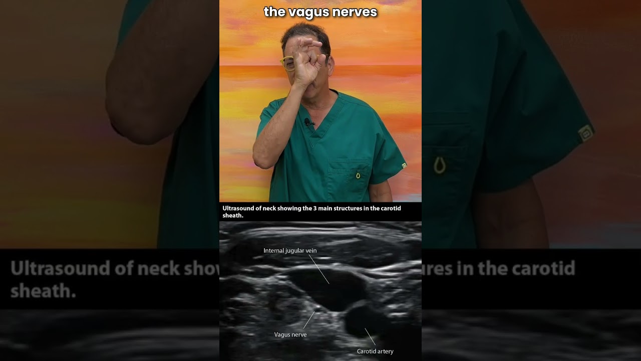 Structural cause of Heart Palpitations- Neck Instability #cervicalspine  #vagopathy #vagusnerve