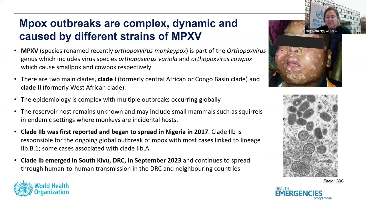Mpox in focus: Global insights on prevention and treatment