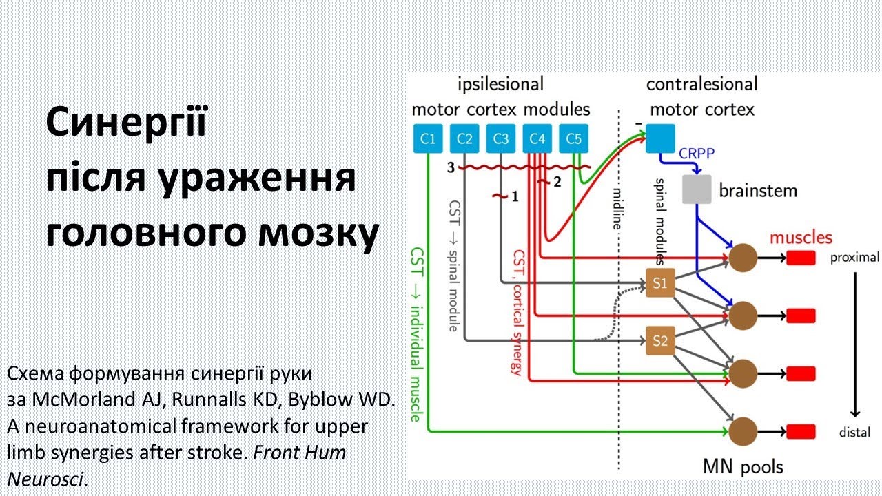 Що таке синергія після ураження головного мозку