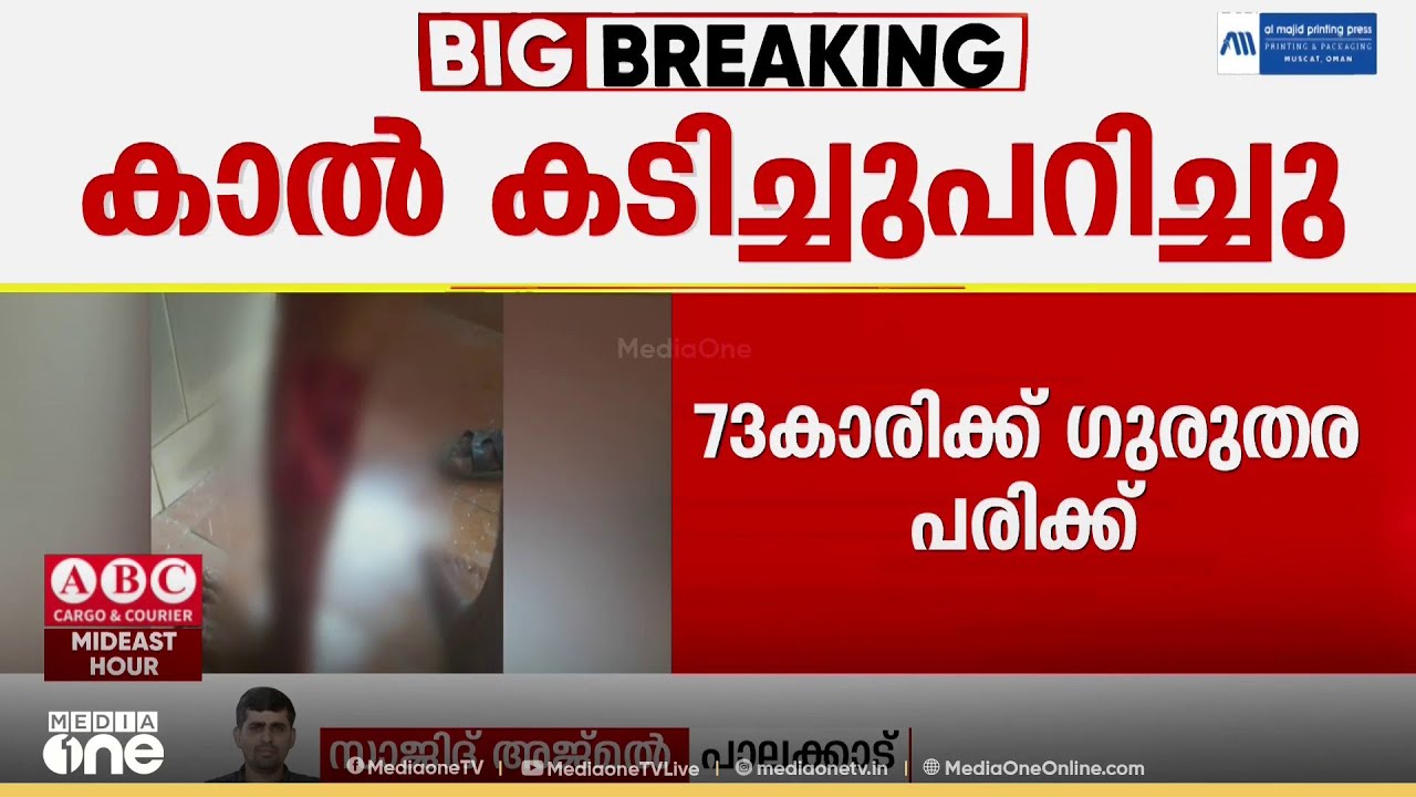 73കാരിയുടെ കാൽ കടിച്ചുപറിച്ച് തെരുവുനായ; ആക്രമണമുണ്ടായത് വീട്ടുമുറ്റത്ത് വെച്ച്