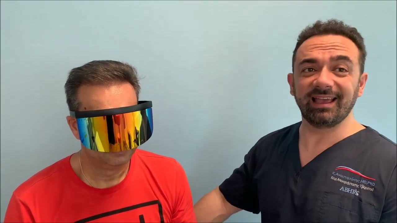 ⭐⭐ ⭐⭐⭐Case #172 - Δείτε το αποτέλεσμα με 3000 FUs - Anastasakis Hair Clinic