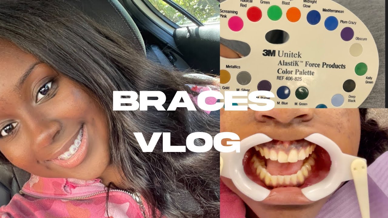 COME GET BRACES WITH ME VLOG  +  (HOW MUCH I PAID)