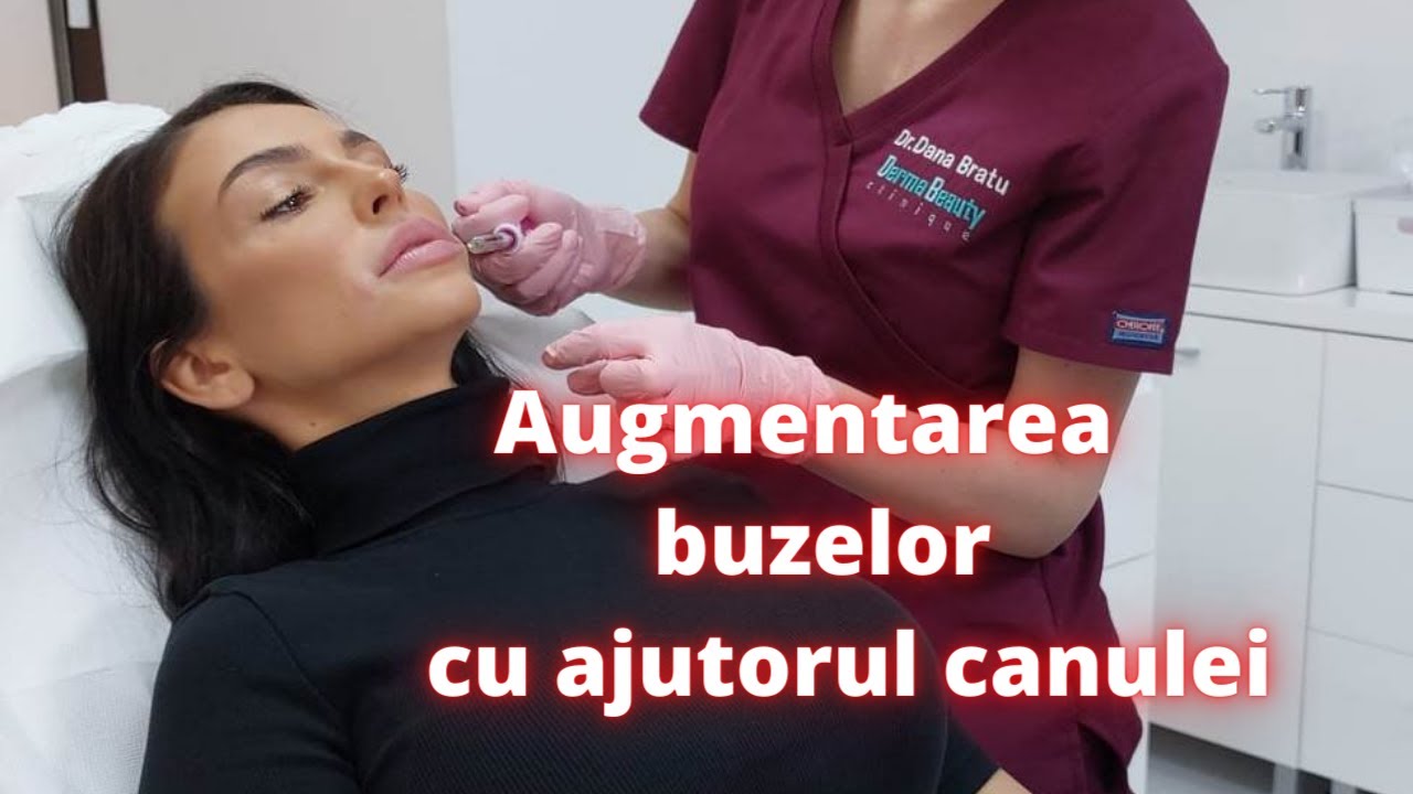 Augmentarea buzelor cu ajutorul canulei | DermaBeauty Clinique