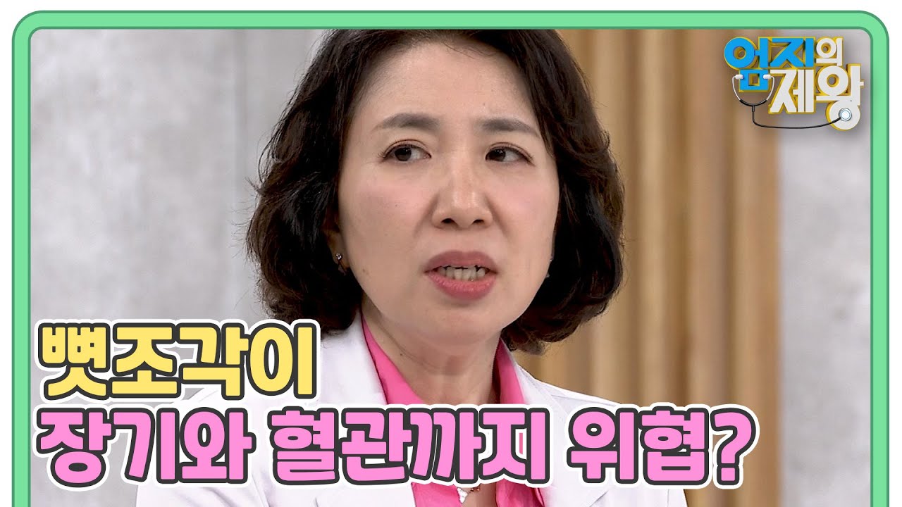 (골다공증의 위험성) 분쇄된 뼛조각이 장기와 혈관까지 위협할 수 있다고? MBN 240827 방송