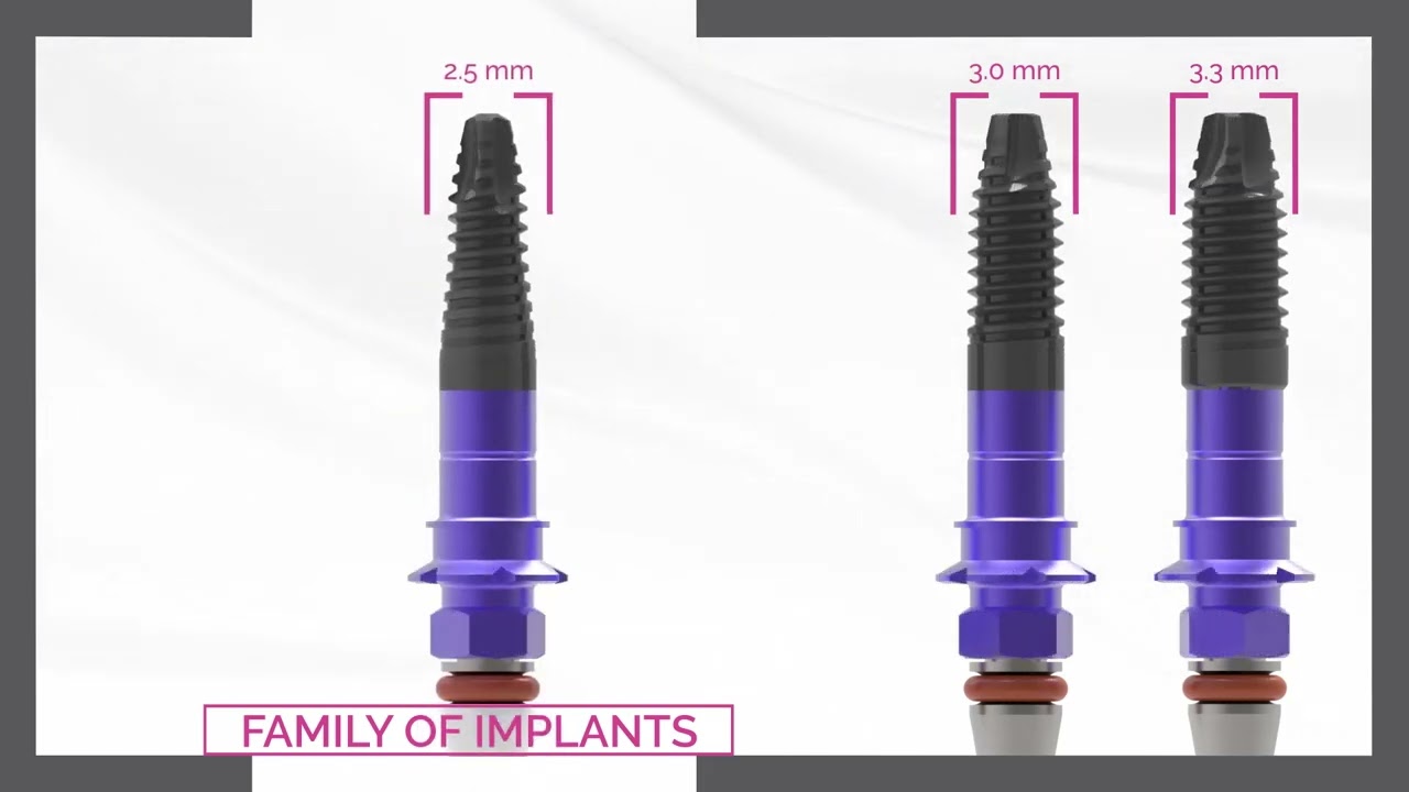 Simplified treatments with BTI 3.0 narrowest implants