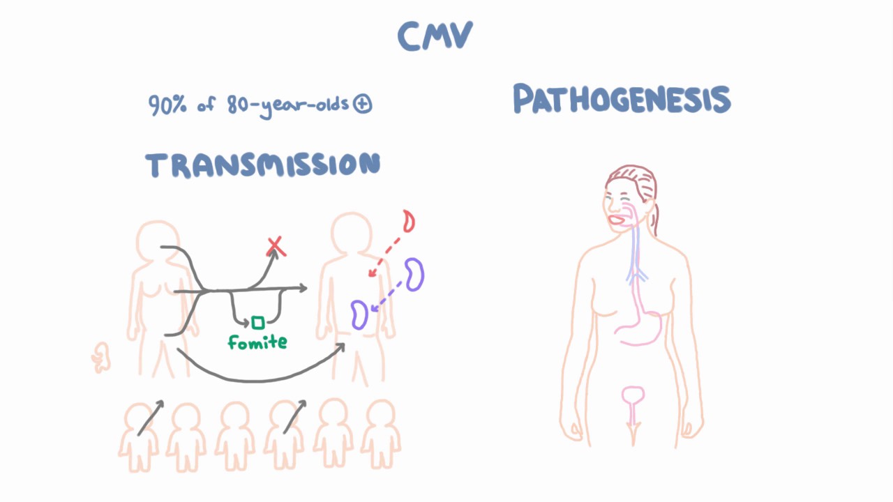 CMV Virology - Epidemiology and Pathophysiology