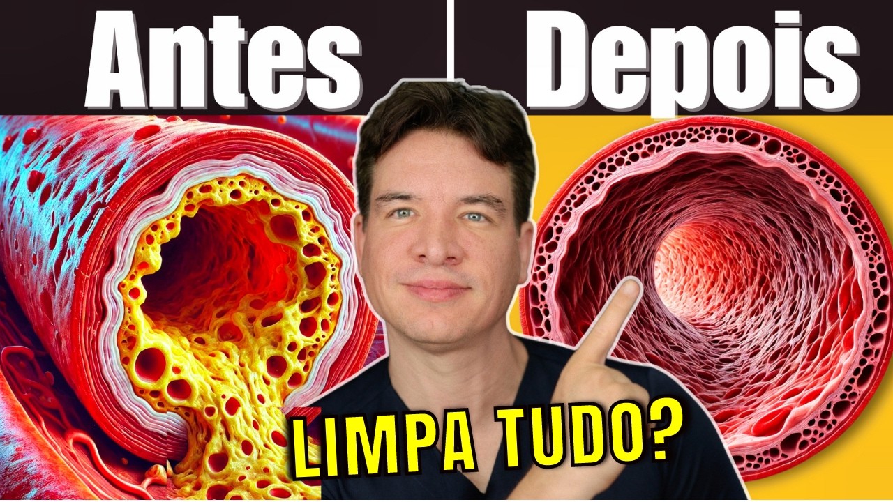 LIMPA as Artérias Entupidas SEM REMÉDIOS!