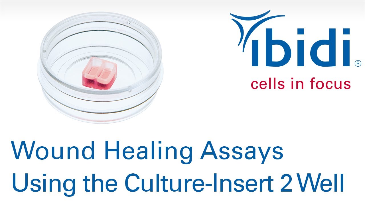 🩹 Wound Healing Assays Using the ibidi Culture-Insert 2 Well