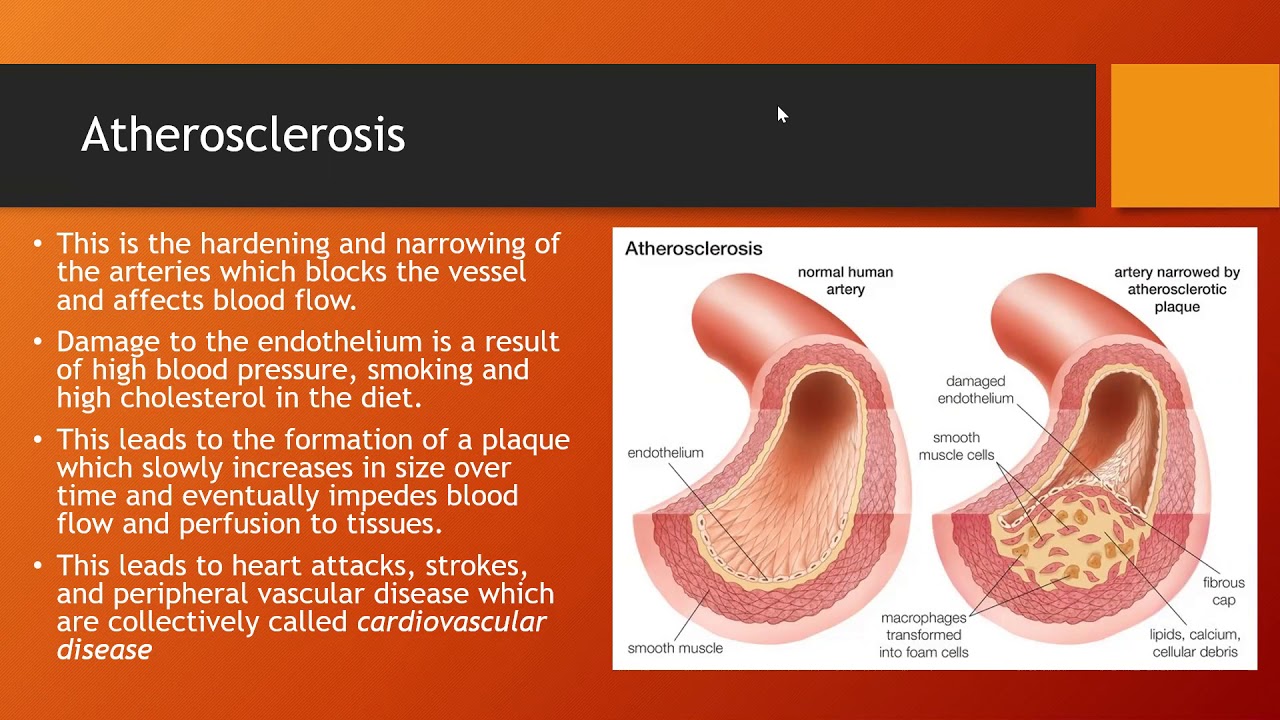 Cardiovascular Aging  Mini lecture
