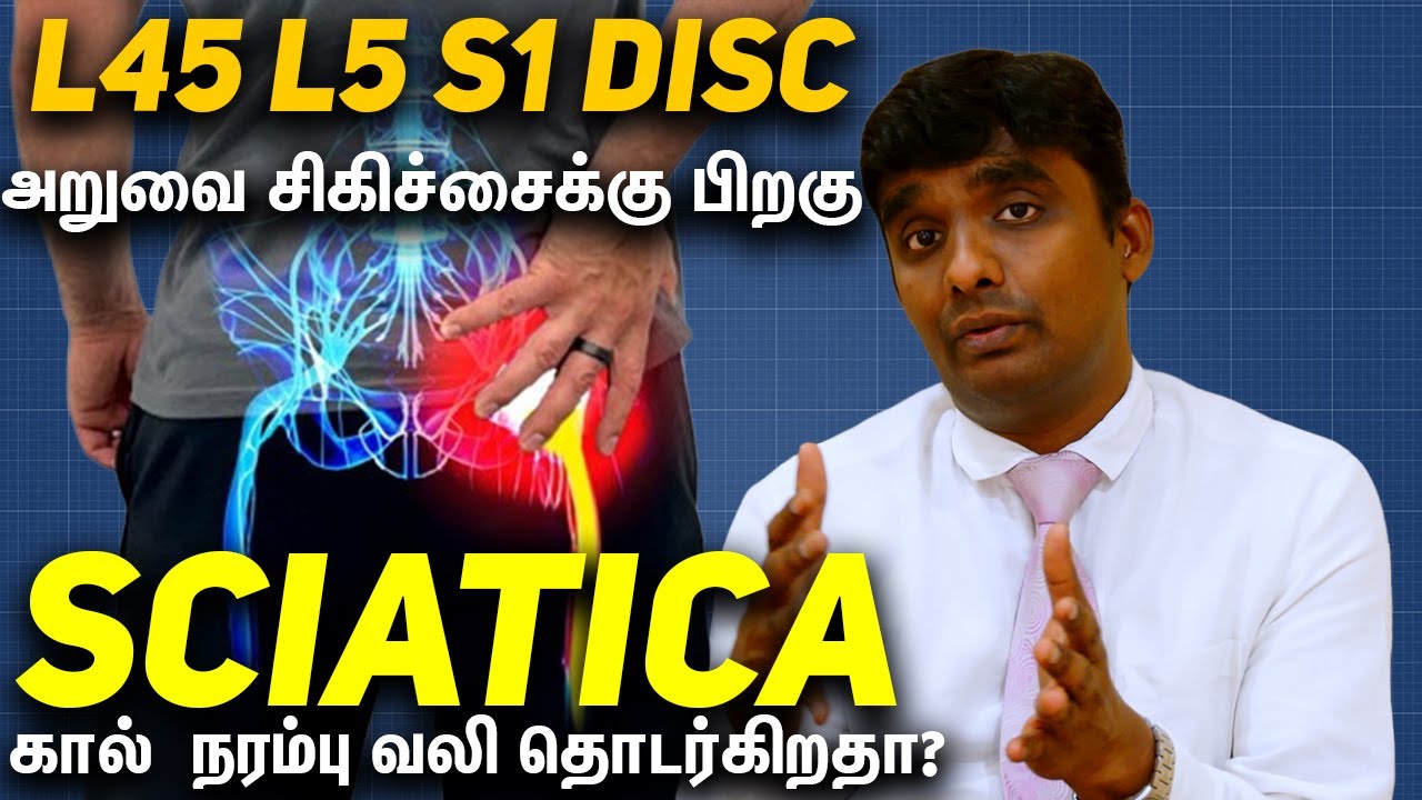 Sciatica L45 L5S1 disc bulge in mri அடுத்து என்ன? Part 5 in Tamil