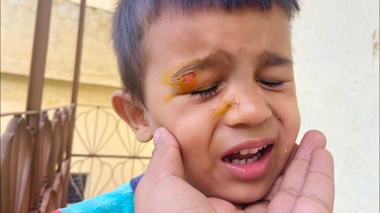 Ruddu Ko Chot Lag Gai Aur Fir...? 😢🥺