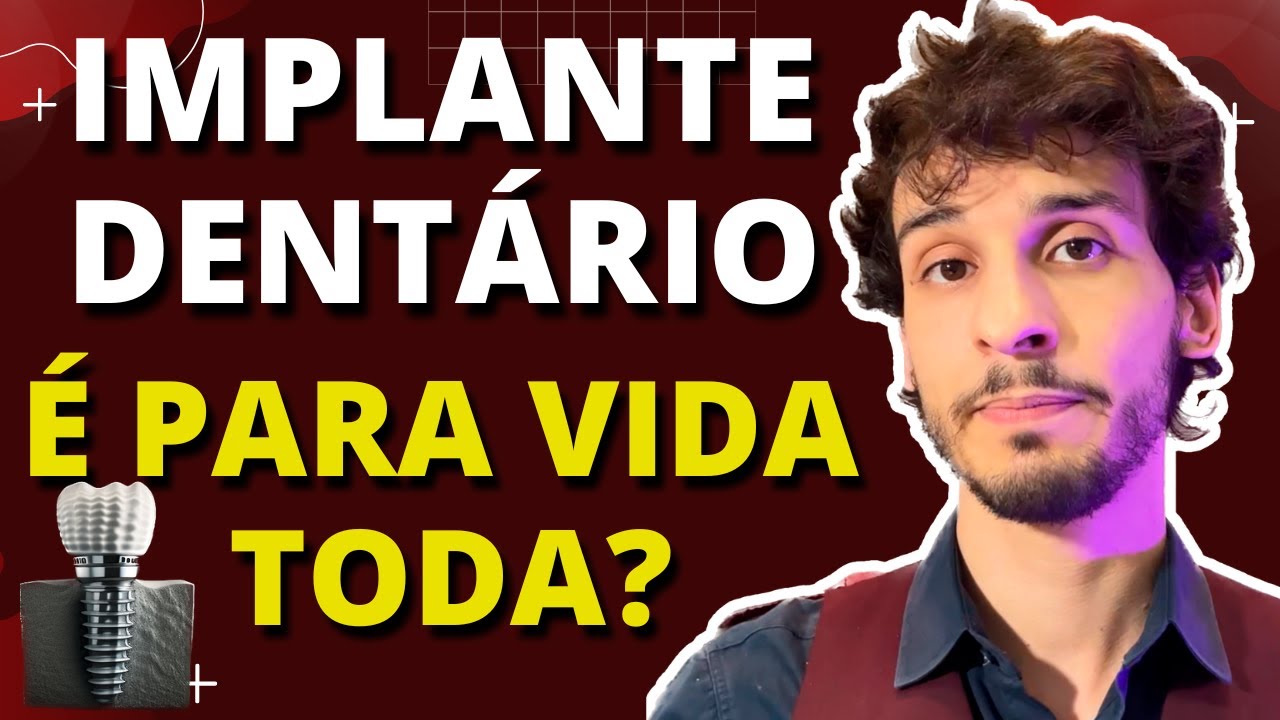Quanto tempo Dura o Implante Dentário?