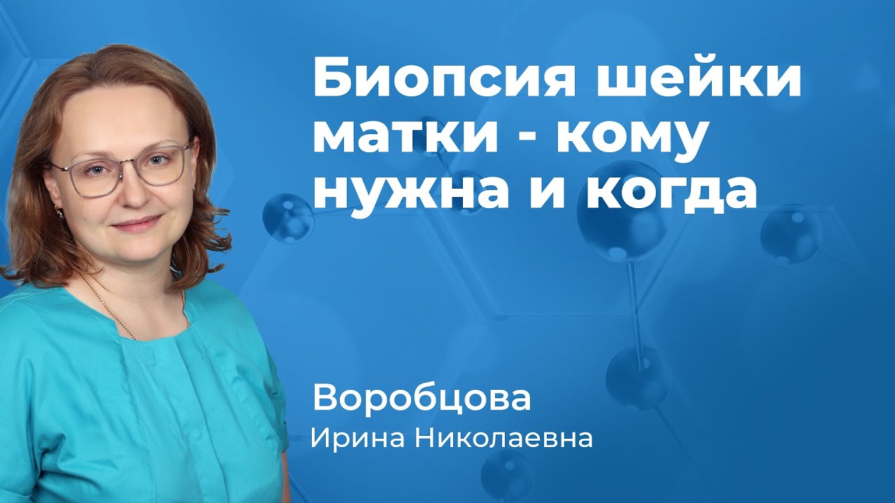 150.05 Биопсия шейки матки - кому нужна и когда. Воробцова Ирина Николаевна,  гинеколог-эндокринолог