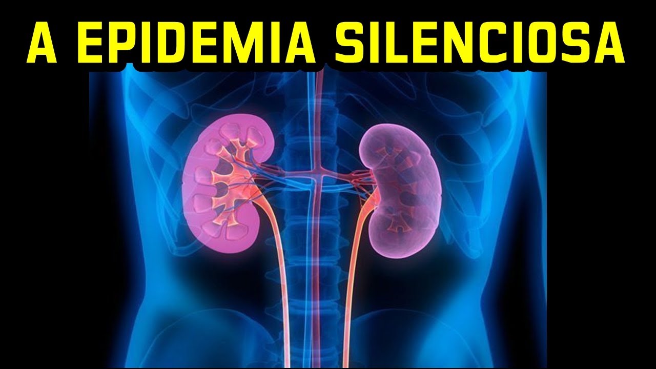 Por Que EXPLODEM os Casos de Doen&ccedil;a RENAL Cr&ocirc;nica no BRASIL ?