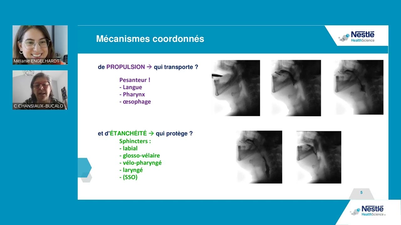 Replay Webinaire : Prise en charge des troubles de la déglutition en cas de maladies neurologiques