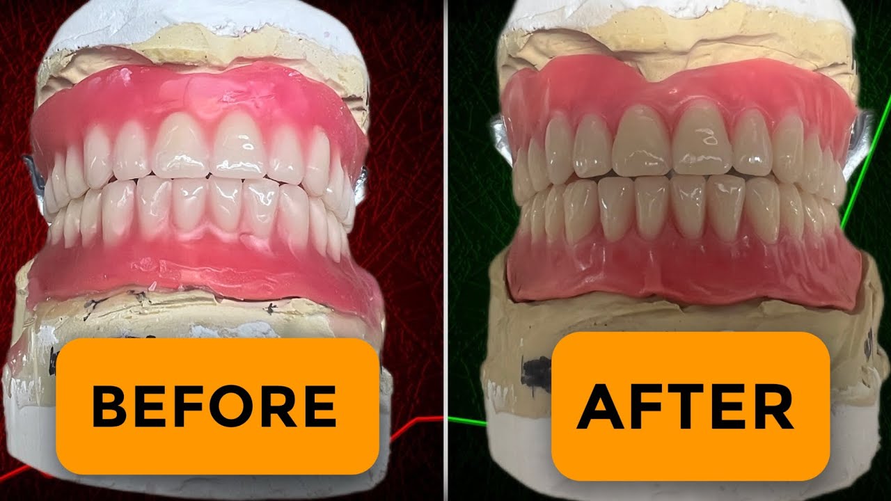 NEW Wax-Up Method March 2026 