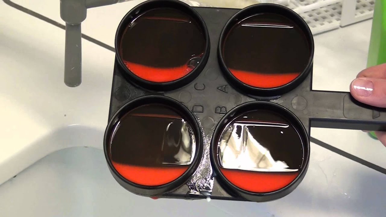California Mastitis Test (engl.)