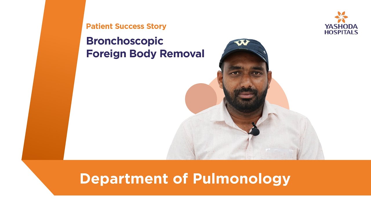 Bronchoscopic Foreign Body Removal | Yashoda Hospitals Hyderabad