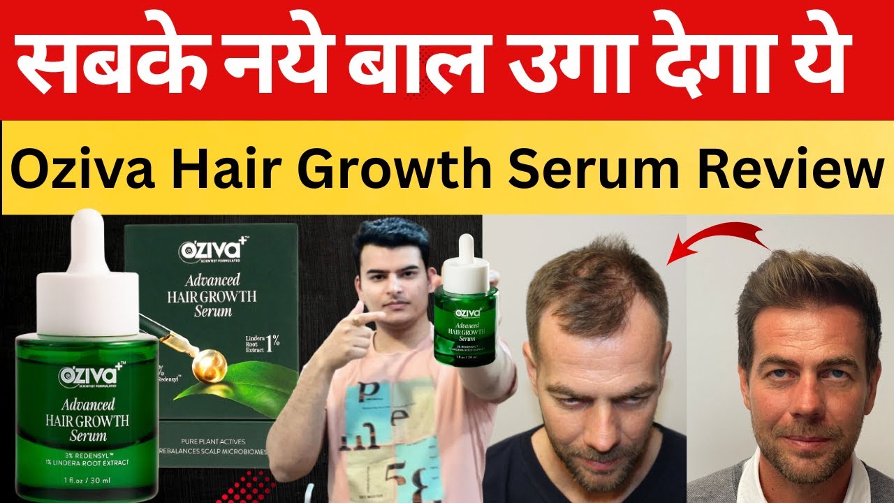 oziva hair serum review | oziva hair growth serum review | oziva advanced hair growth serum review